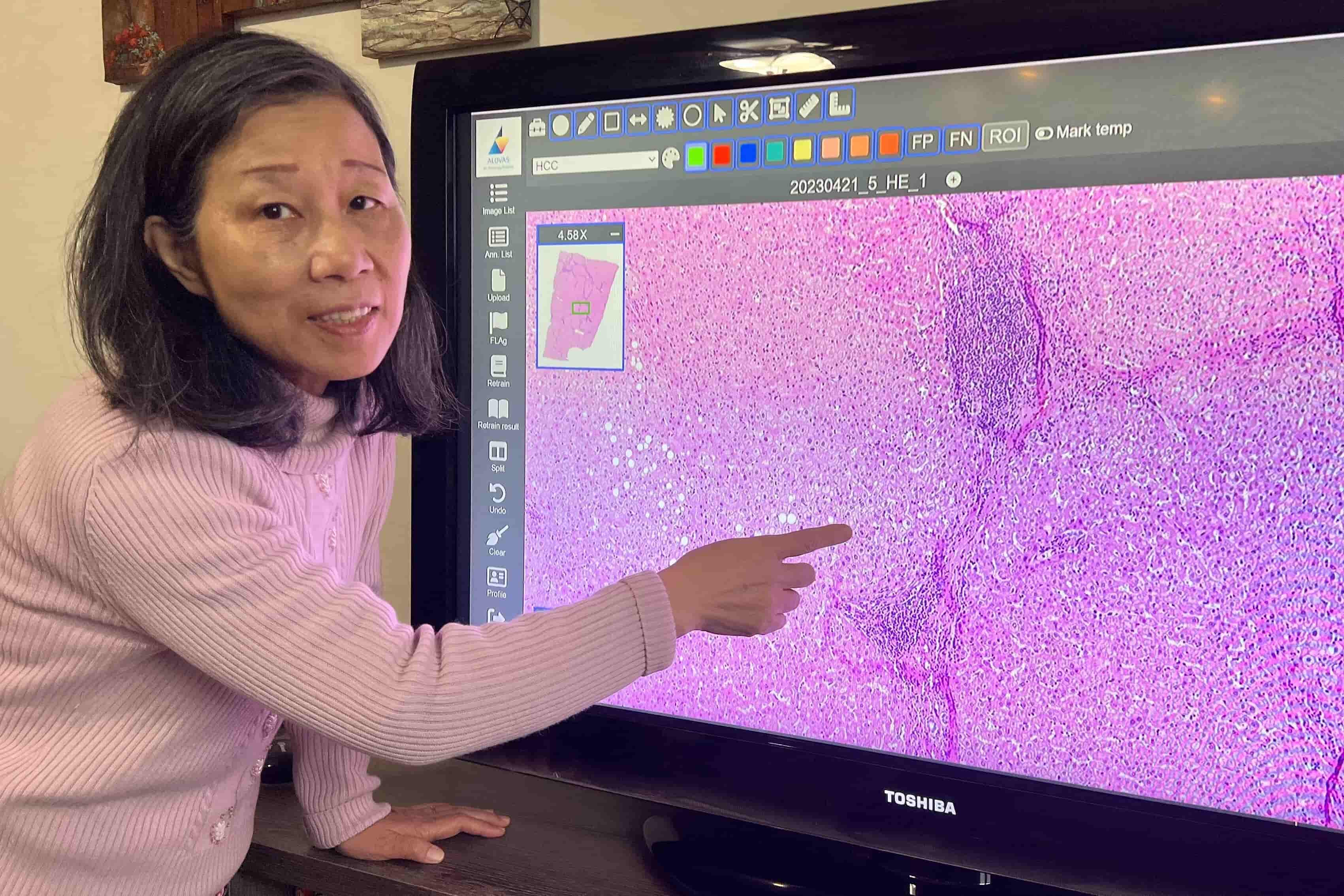 成大詹寶珠教授團隊醫療器材軟體「成功大學數位病理影像平台」　走出學術研究進入實際應用